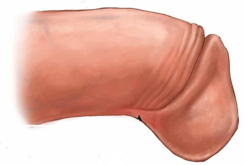 how to enlarge penis glas